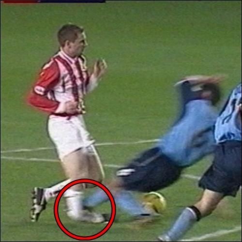 Cầu thủ người CH Ireland, Colin Healy (Sunderland), bị Youssef Safri (Coventry) phi thẳng gầm giày vào ống đồng năm 2003.